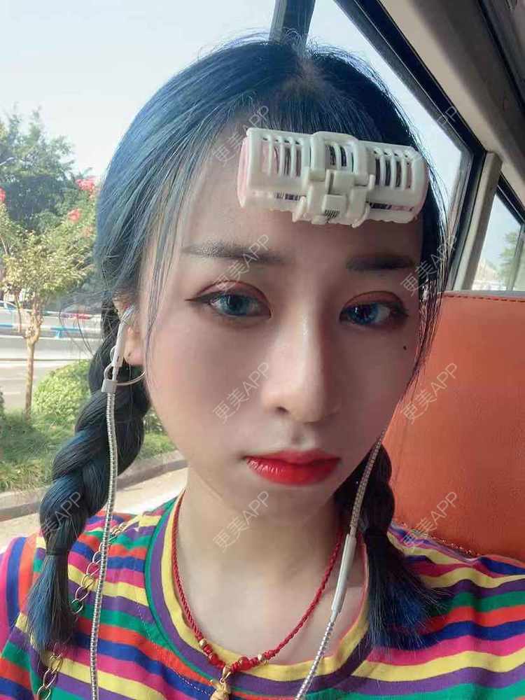 更美 - 饭冰冰儿的鼻部多项经验 | 鼻部多项 | 硅胶隆鼻 | 鹰钩鼻矫正 | 肋软骨隆鼻 | 鼻翼缩小