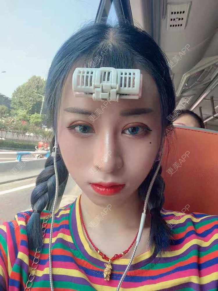 更美 - 饭冰冰儿的鼻部多项经验 | 鼻部多项 | 硅胶隆鼻 | 鹰钩鼻矫正 | 肋软骨隆鼻 | 鼻翼缩小