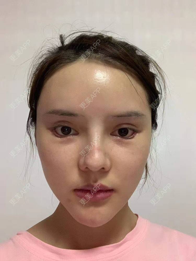 更美用户gqhvtvcolg的开外眼角日记