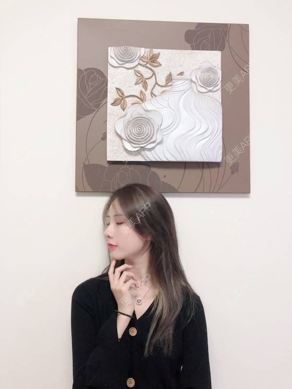 更美 - 七彩百香柠檬茶的鼻部多项经验 | 鼻小柱延长 | 自体软骨垫鼻尖 | 鼻部多项 | 硅胶隆鼻 | 肋软骨隆鼻 | 重庆 | 鼻翼缩小