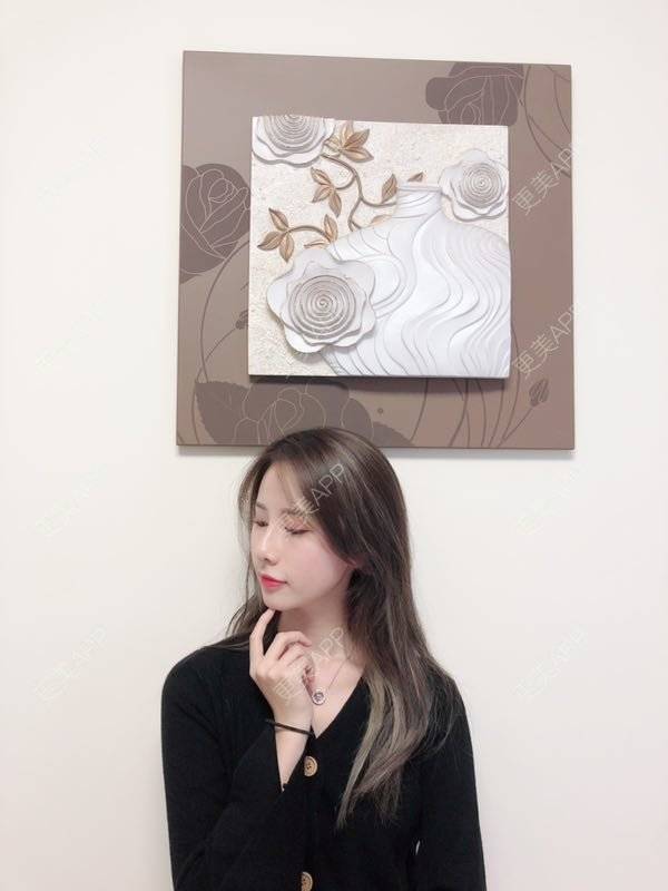 更美 - 七彩百香柠檬茶的鼻部多项经验 | 鼻小柱延长 | 自体软骨垫鼻尖 | 鼻部多项 | 硅胶隆鼻 | 肋软骨隆鼻 | 重庆 | 鼻翼缩小