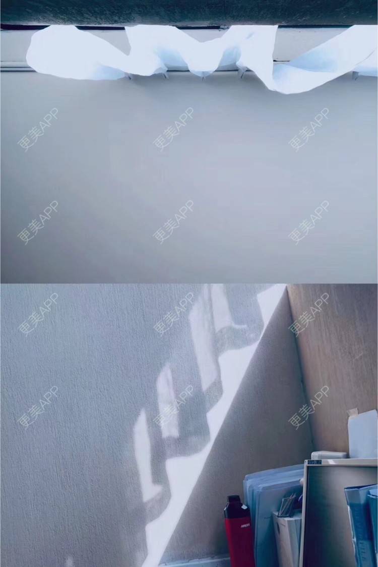 更美 - Kel🐯🐯的超声波洗牙经验 | 成都 | 超声波洗牙