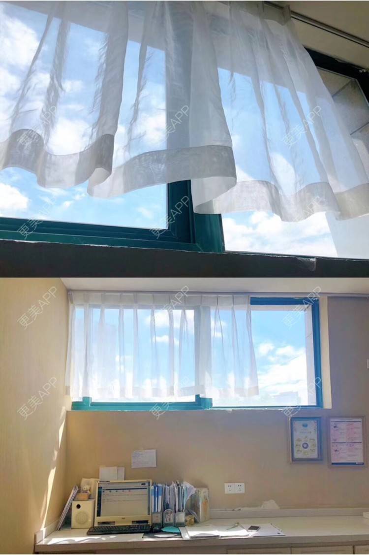 更美 - Kel🐯🐯的超声波洗牙经验 | 成都 | 超声波洗牙