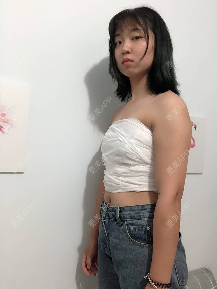 小铃铛铛铛铛的丰胸隆胸日记