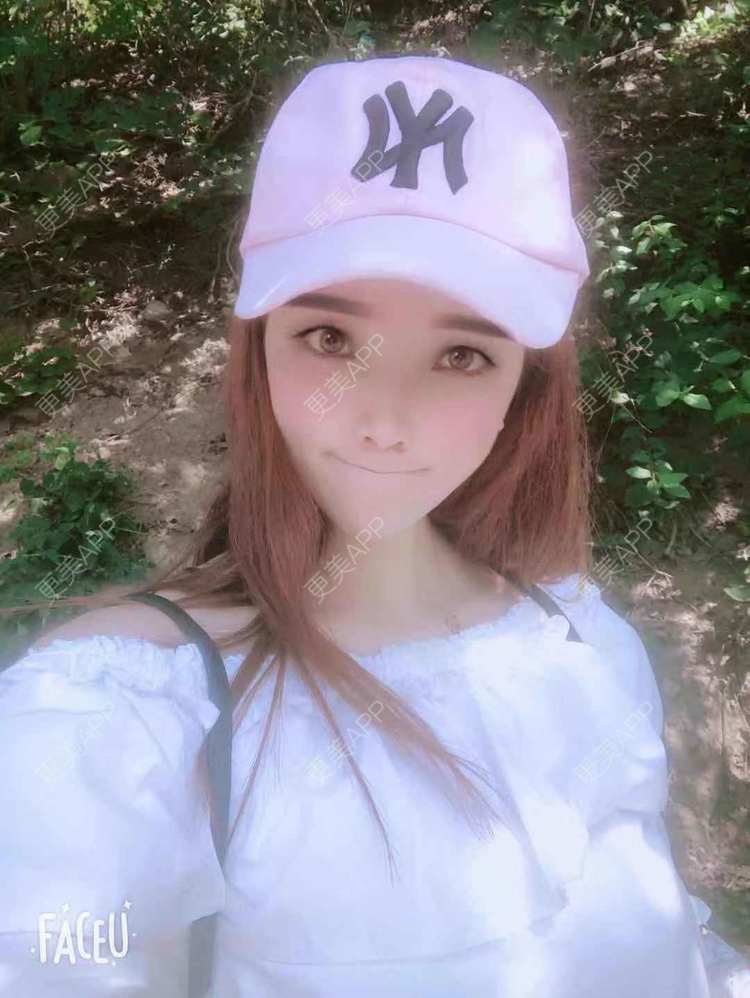 更美 - 更美用户EWqDuvHmIb的自体脂肪丰面颊经验 | 自体脂肪丰面颊 | 成都
