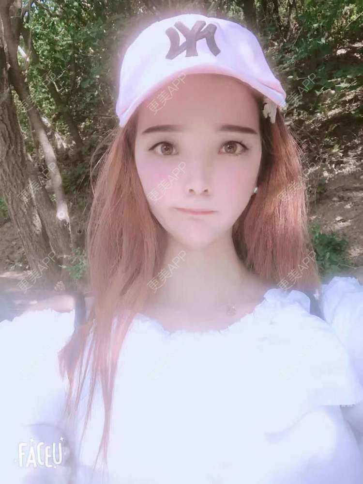 更美 - 更美用户EWqDuvHmIb的自体脂肪丰面颊经验 | 自体脂肪丰面颊 | 成都