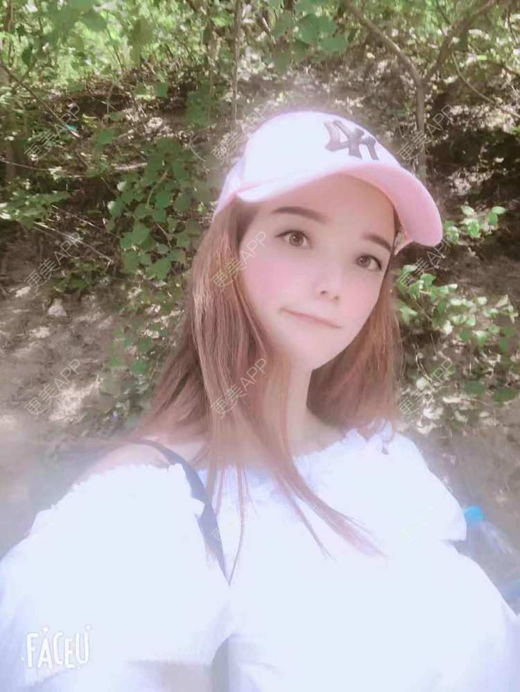 更美 - 更美用户EWqDuvHmIb的自体脂肪丰面颊经验 | 自体脂肪丰面颊 | 成都