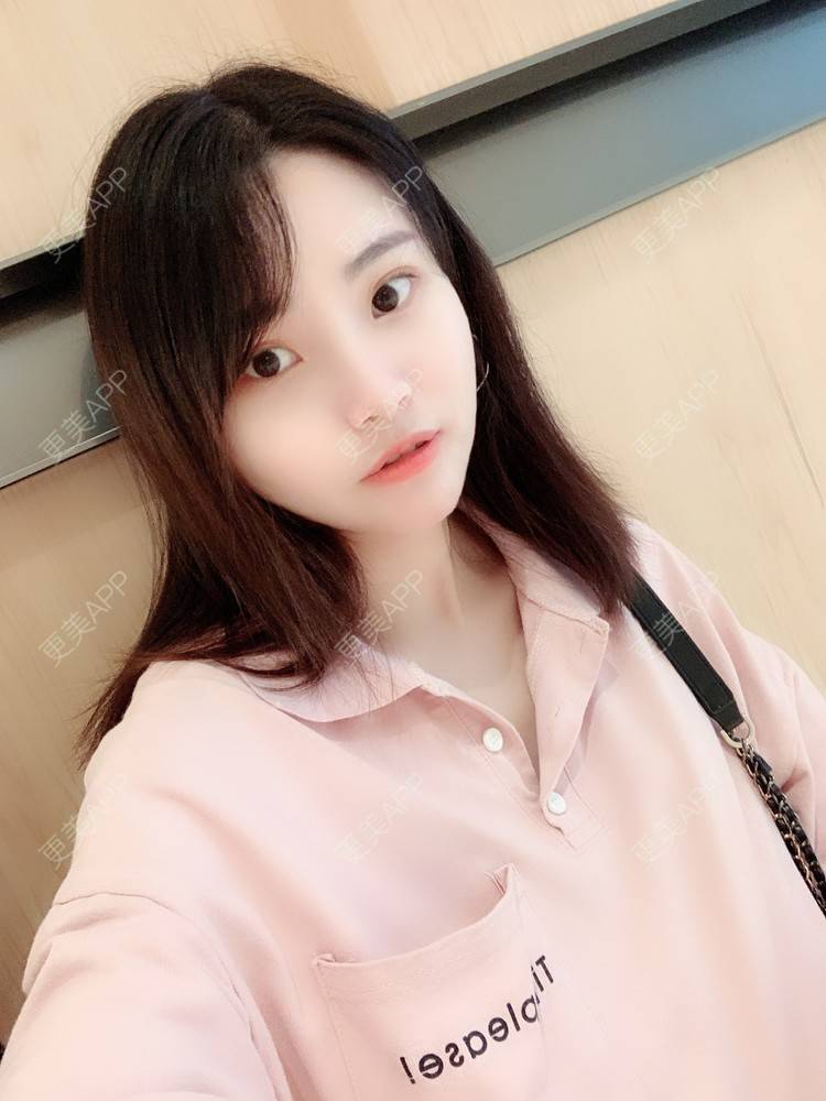 更美 - 大美人图的自体脂肪丰额头经验 | 更美研究所 | 自体脂肪丰额头 | 杭州