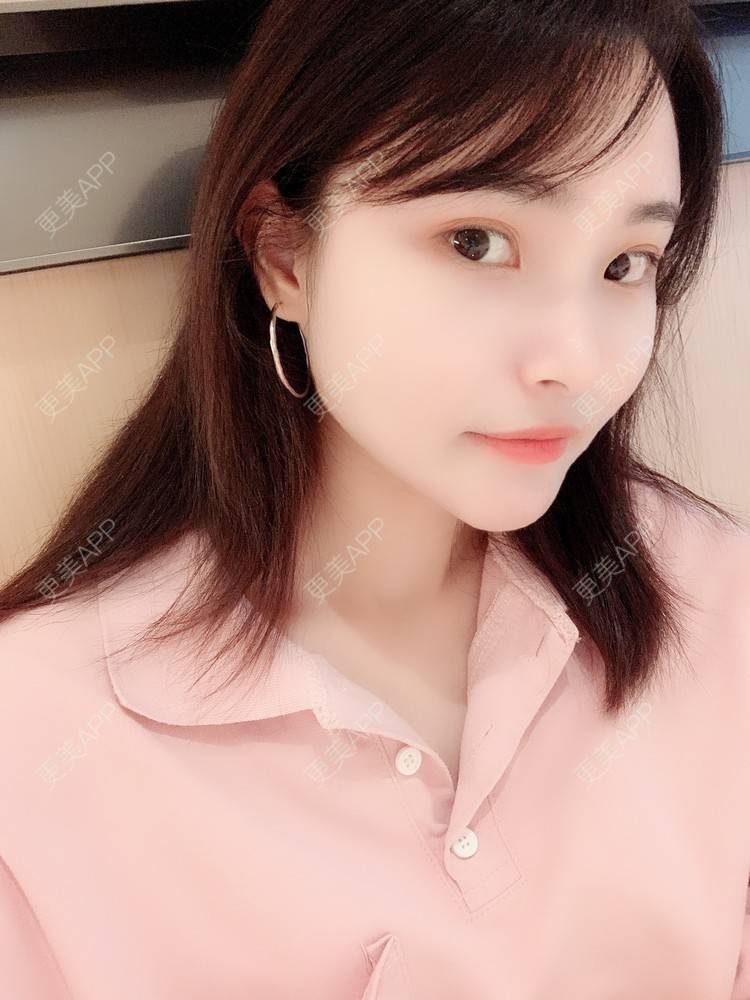 更美 - 大美人图的自体脂肪丰额头经验 | 更美研究所 | 自体脂肪丰额头 | 杭州