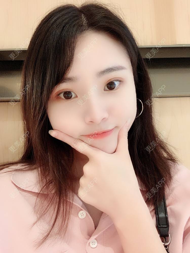 更美 - 大美人图的自体脂肪丰额头经验 | 更美研究所 | 自体脂肪丰额头 | 杭州