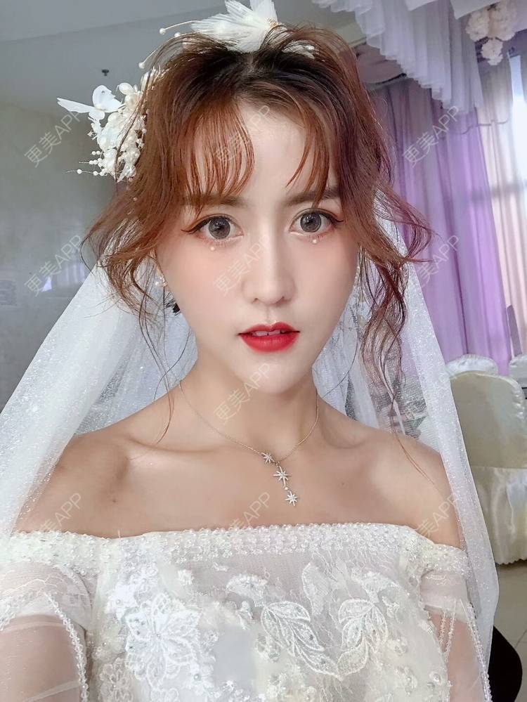 更美 - 心如 止水的自体脂肪丰面颊经验 | 自体脂肪丰面颊 | 成都