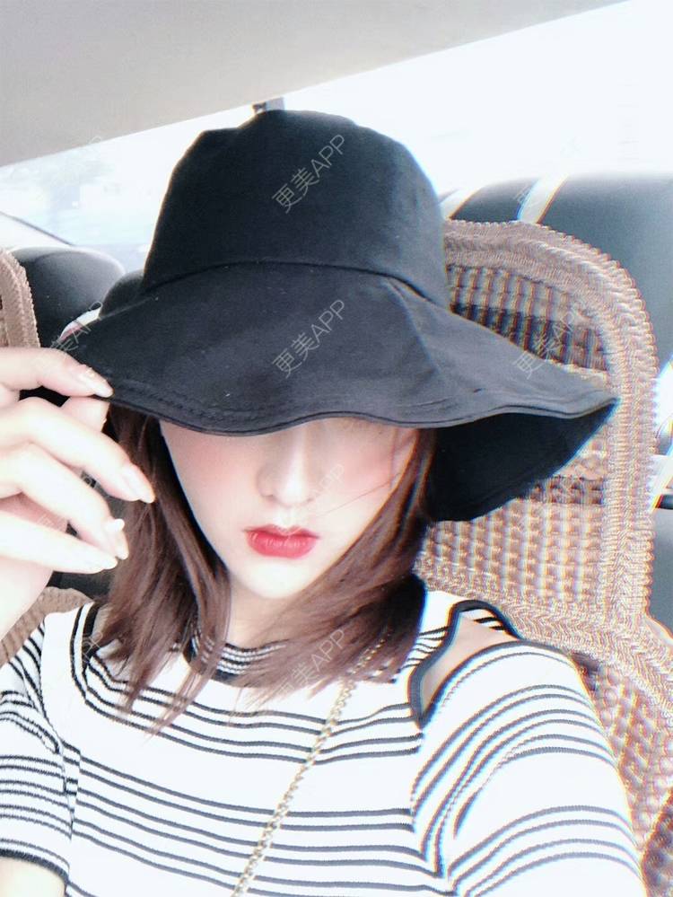 更美 - 心如 止水的自体脂肪丰面颊经验 | 自体脂肪丰面颊 | 成都