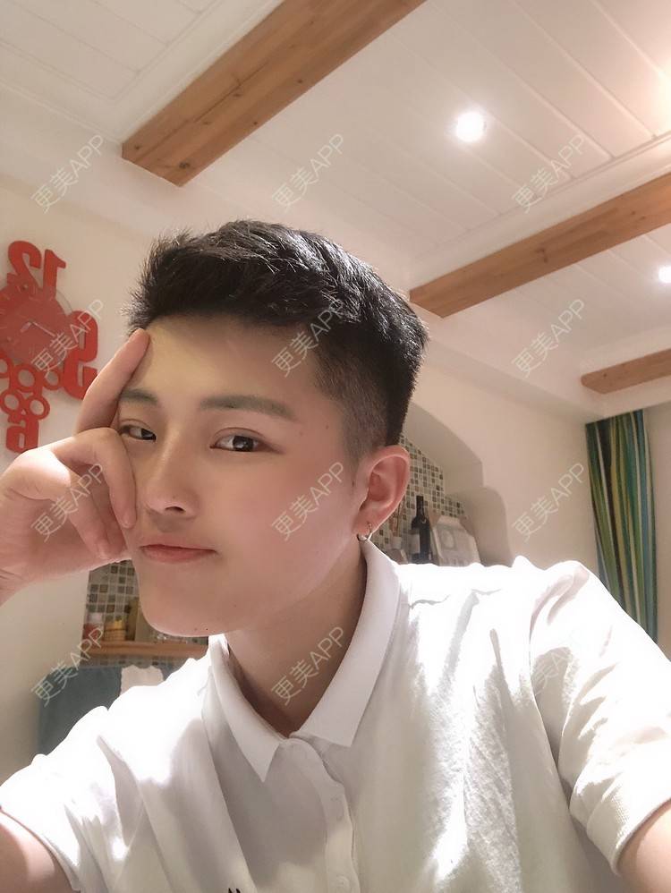 更美 - 更美用户jElE6LuBhW的厚唇改薄经验 | 厚唇改薄 | 微笑唇手术 | M唇成形 | 成都