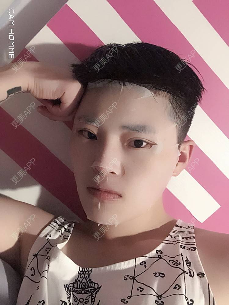 更美 - 更美用户jElE6LuBhW的厚唇改薄经验 | 厚唇改薄 | 微笑唇手术 | M唇成形 | 成都