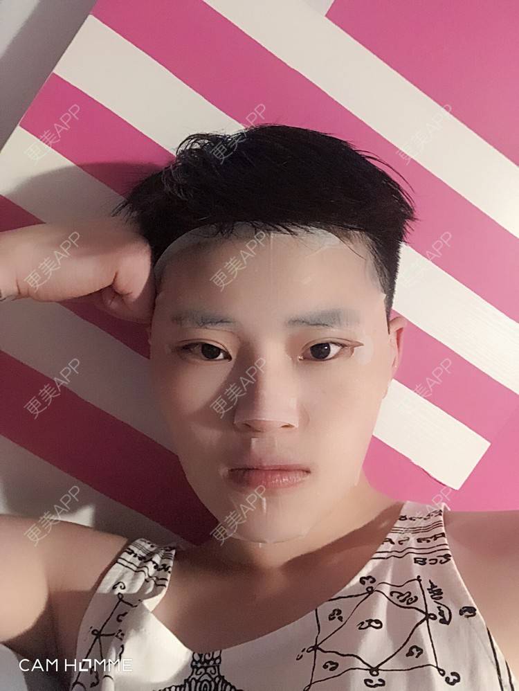 更美 - 更美用户jElE6LuBhW的厚唇改薄经验 | 厚唇改薄 | 微笑唇手术 | M唇成形 | 成都