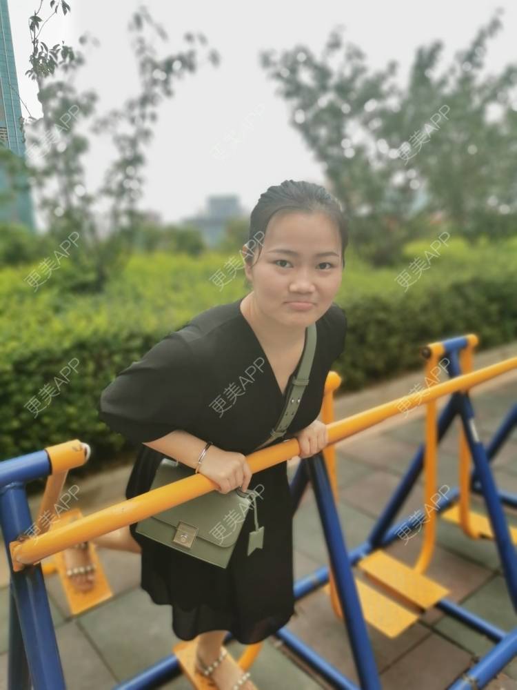 更美 - 花花cd的隆鼻经验 | 隆鼻 | 膨体隆鼻 | 鼻中隔软骨隆鼻 | 鼻孔矫正 | 鼻部多项 | 郑州