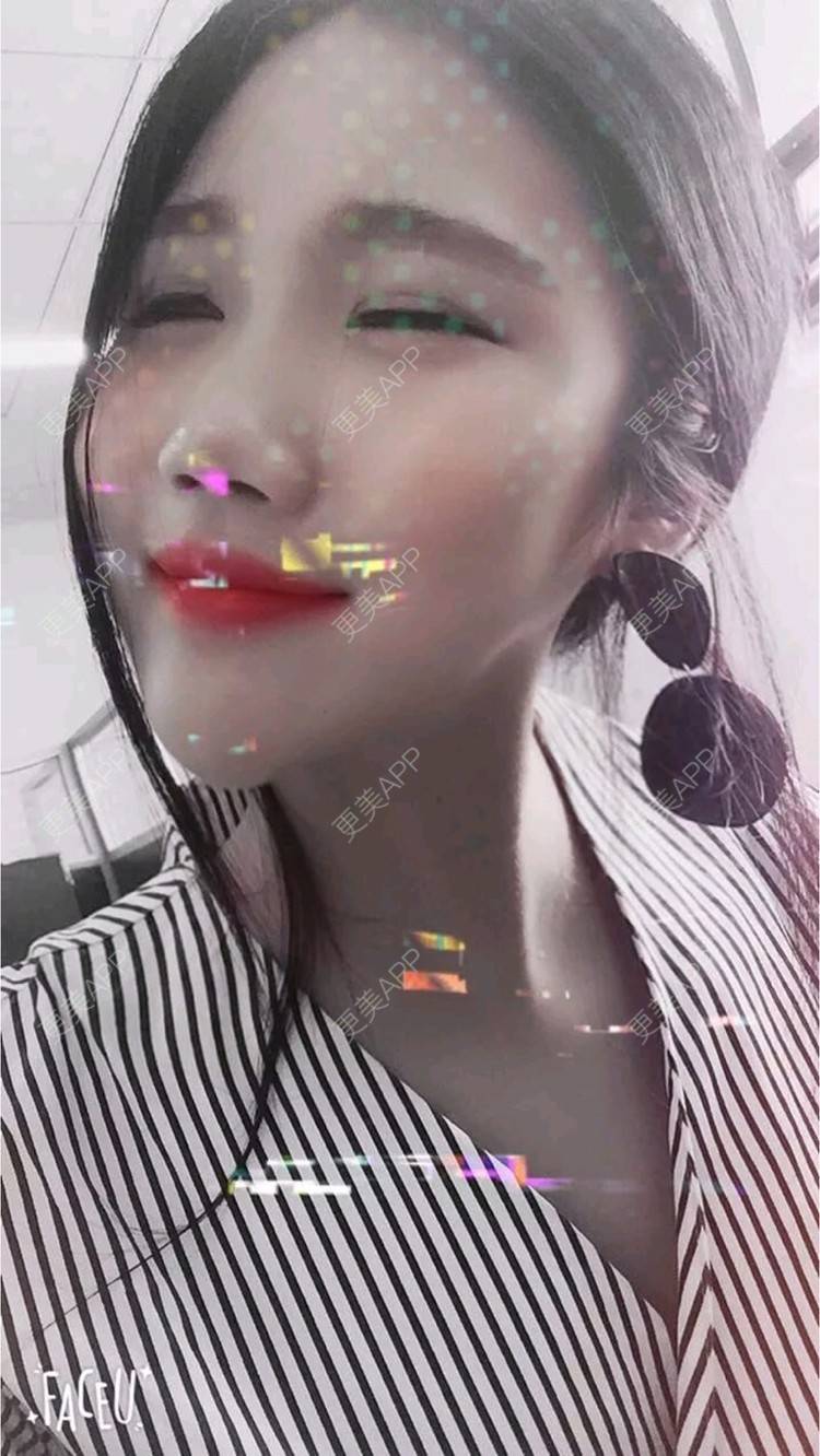 更美 - 更美用户UOBtscnpIq的处女膜修复经验 | 处女膜修复 | 深圳