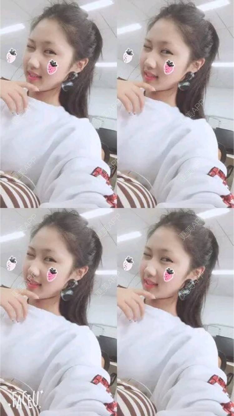 更美 - 更美用户UOBtscnpIq的处女膜修复经验 | 处女膜修复 | 深圳