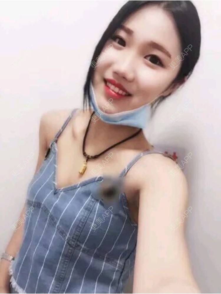 更美 - 更美用户UOBtscnpIq的处女膜修复经验 | 处女膜修复 | 深圳