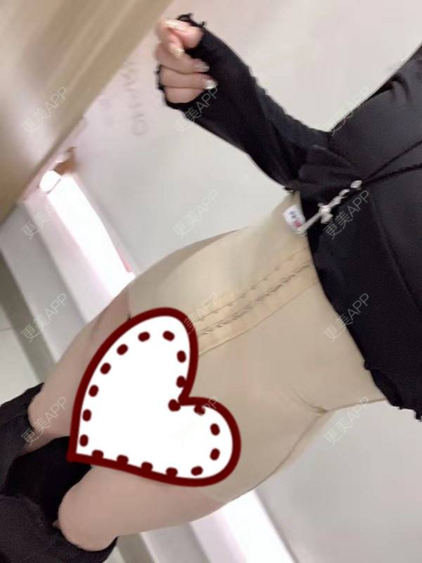 茹花似玉1的腰腹吸脂日记