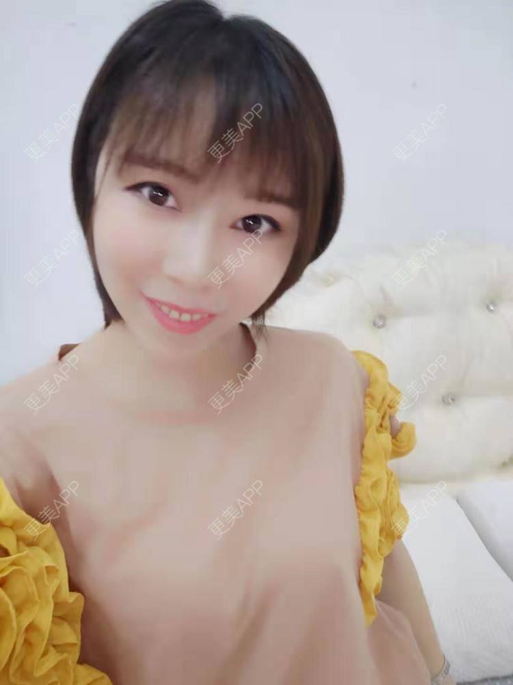 更美 - hu7676的太阳穴经验 | 视频日记 | 膨体丰太阳穴 | 武汉 | 自体脂肪丰太阳穴 | 玻尿酸太阳穴 | 硅胶丰太阳穴 | 太阳穴 | 胶原蛋白丰太阳穴