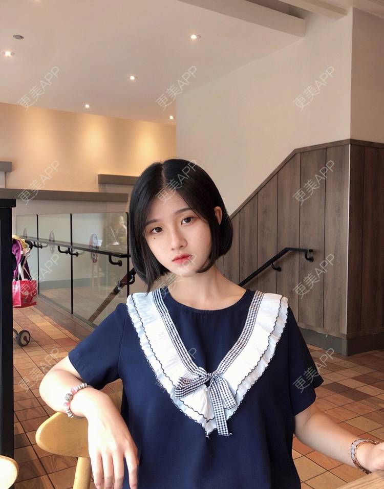 更美 - 罗兰儿的牙齿瓷贴面经验 | 成都 | 牙齿瓷贴面