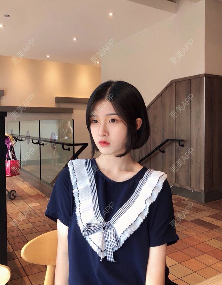 更美 - 罗兰儿的牙齿瓷贴面经验 | 成都 | 牙齿瓷贴面