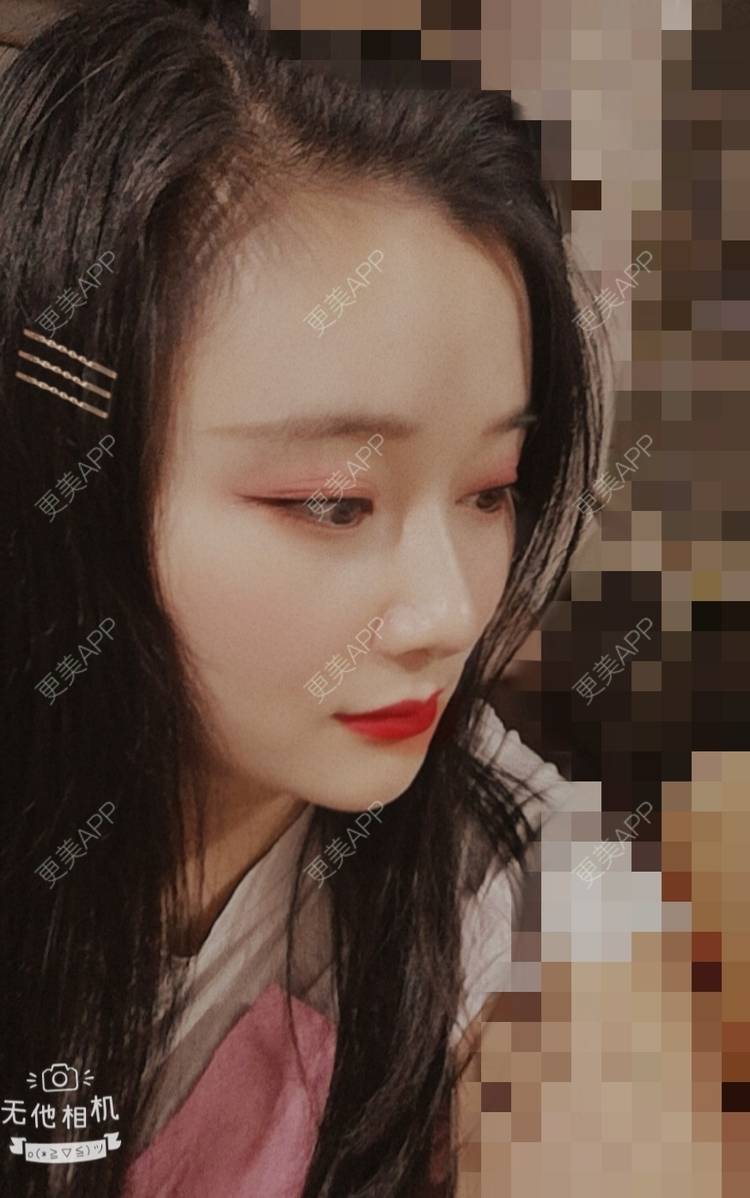 更美 - 更美用户J1mgNZN5cT的鼻部多项经验 | 鼻部多项 | 成都