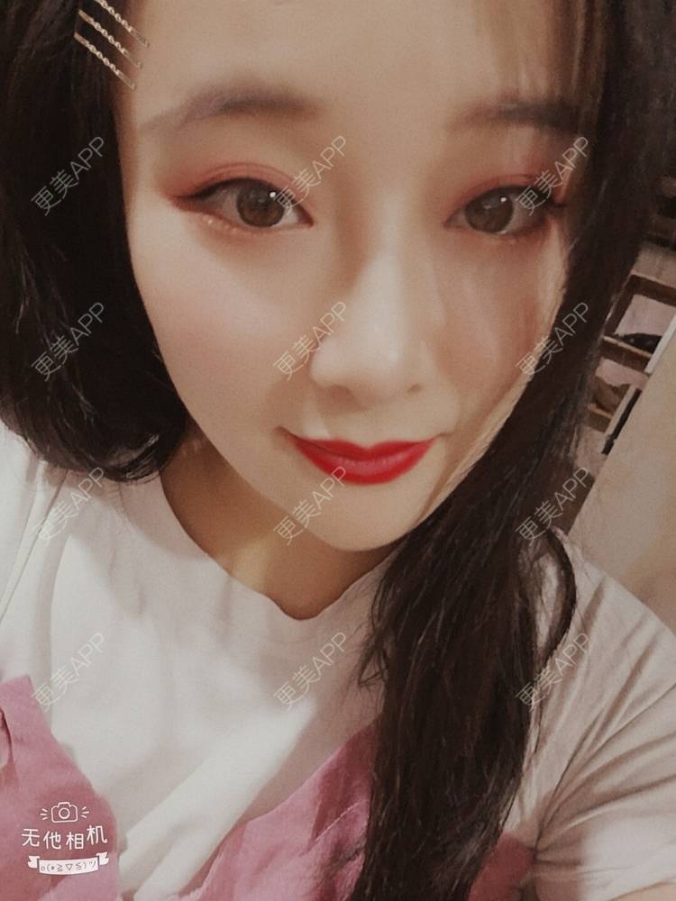更美 - 更美用户J1mgNZN5cT的鼻部多项经验 | 鼻部多项 | 成都