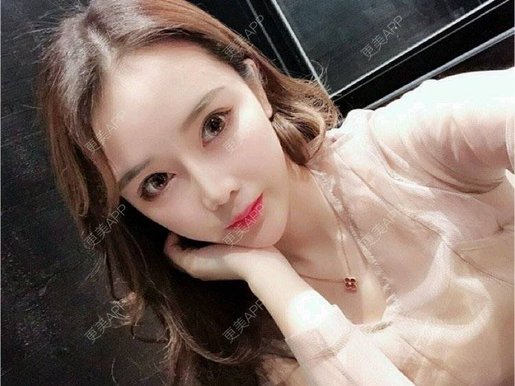 更美 - 怼怹恏尘的玻尿酸面部细纹经验 | 玻尿酸面部细纹 | 杭州