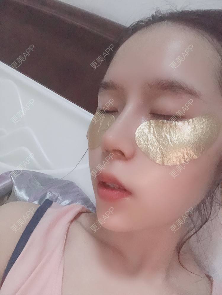 更美 - 超级超级好吃的下巴经验 | 膨体垫下巴 | 硅胶垫下巴 | 人工骨垫下巴 | 胶原蛋白丰下巴 | 玻尿酸下巴 | 自体脂肪垫下巴
