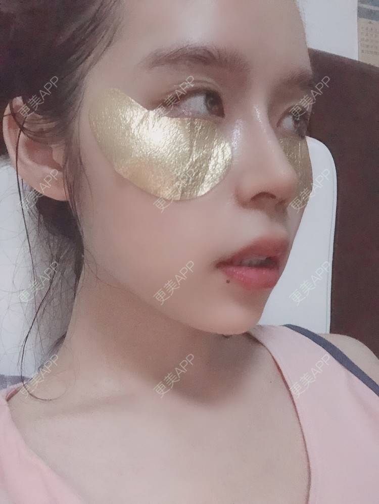 更美 - 超级超级好吃的下巴经验 | 膨体垫下巴 | 硅胶垫下巴 | 人工骨垫下巴 | 胶原蛋白丰下巴 | 玻尿酸下巴 | 自体脂肪垫下巴