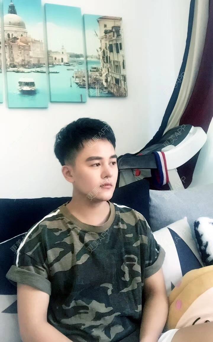 更美 - 俊男靓仔的植眉经验 | 植眉