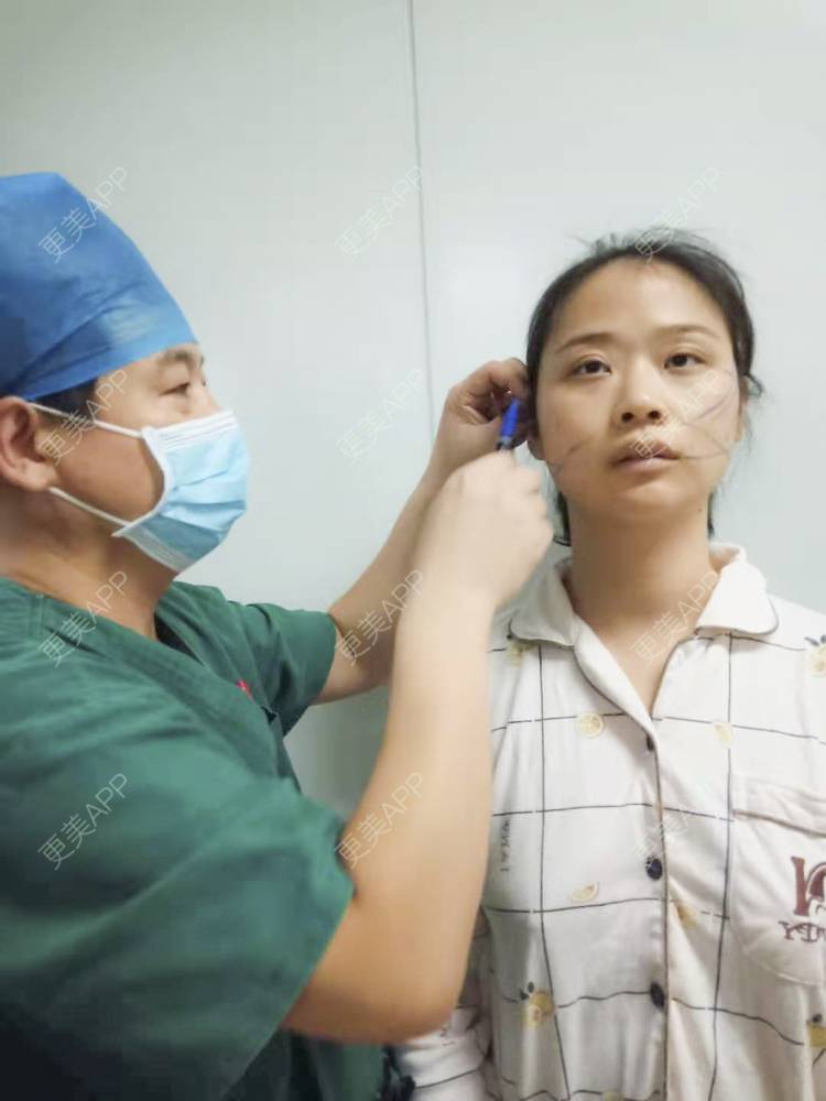 更美 - 更美用户x7HyDBFrd3的经验 | 埋线除皱 | 埋线提升 | 北京