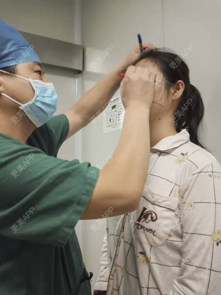 更美 - 更美用户x7HyDBFrd3的经验 | 埋线除皱 | 埋线提升 | 北京