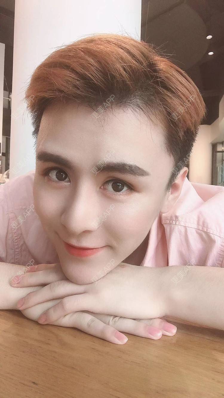 更美 - 陈温柔~的膨体垫眉弓经验 | 膨体垫眉弓 | 视频日记 | 重庆