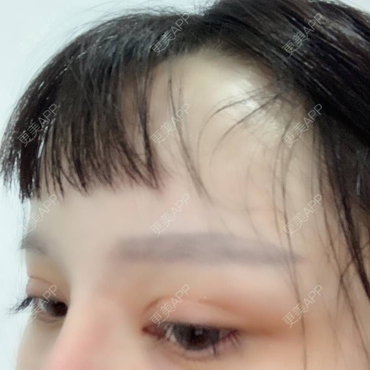 更美 - 更美用户qPl9XqbpZ9的洗眼线经验 | 洗眼线 | 郑州