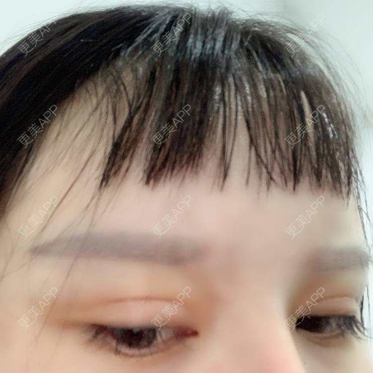 更美 - 更美用户qPl9XqbpZ9的洗眼线经验 | 洗眼线 | 郑州