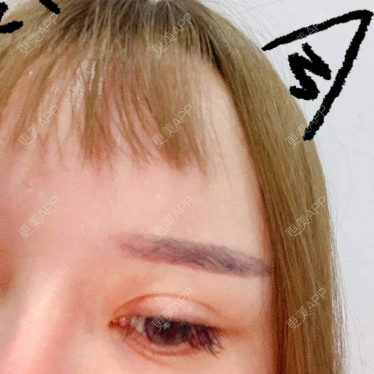 更美 - 更美用户qPl9XqbpZ9的洗眼线经验 | 洗眼线 | 郑州
