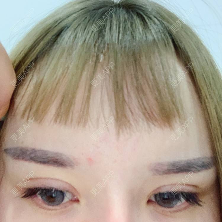 更美 - 更美用户qPl9XqbpZ9的洗眼线经验 | 洗眼线 | 郑州