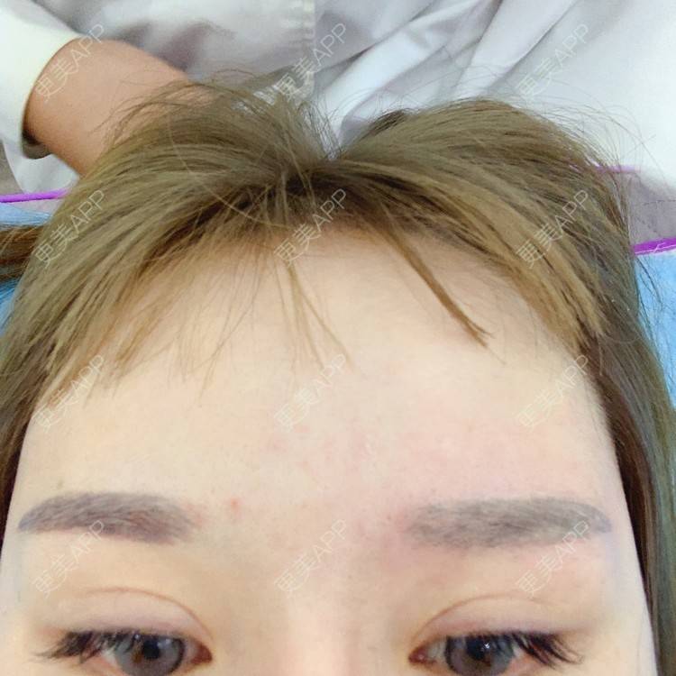 更美 - 更美用户qPl9XqbpZ9的洗眼线经验 | 洗眼线 | 郑州