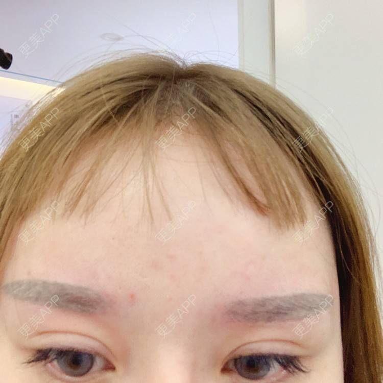 更美 - 更美用户qPl9XqbpZ9的洗眼线经验 | 洗眼线 | 郑州