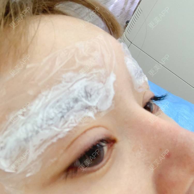 更美 - 更美用户qPl9XqbpZ9的洗眼线经验 | 洗眼线 | 郑州