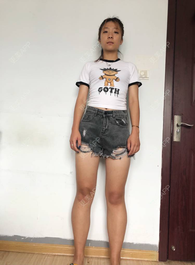 独来独往58的除皱瘦脸瘦腿日记