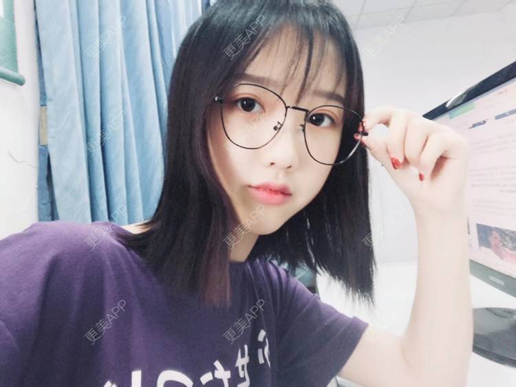更美 - 萌萌呢的自体脂肪丰面颊经验 | 视频日记 | 自体脂肪填充泪沟 | 自体脂肪丰苹果肌 | 自体脂肪丰面颊 | 武汉 | 自体脂肪全面部填充