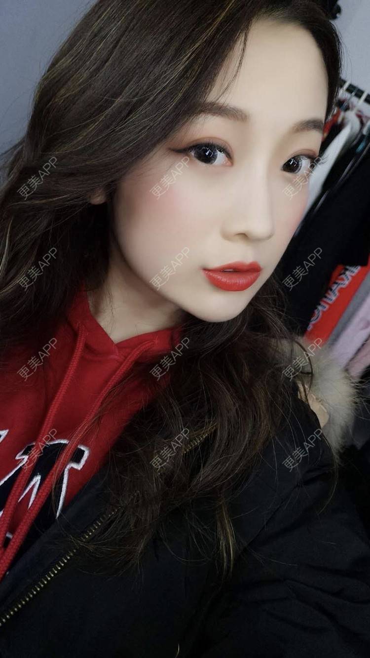 更美 - 更美用户5zukLulK2p的激光去眼袋经验 | 激光去眼袋