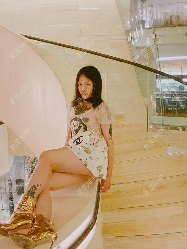 更美 - 活埋真心的自体脂肪填充泪沟经验 | 自体脂肪全面部填充 | 自体脂肪丰额头 | 自体脂肪丰太阳穴 | 自体脂肪丰面颊 | 自体脂肪填充泪沟 | 自体脂肪丰苹果肌 | 自体脂肪垫眉弓