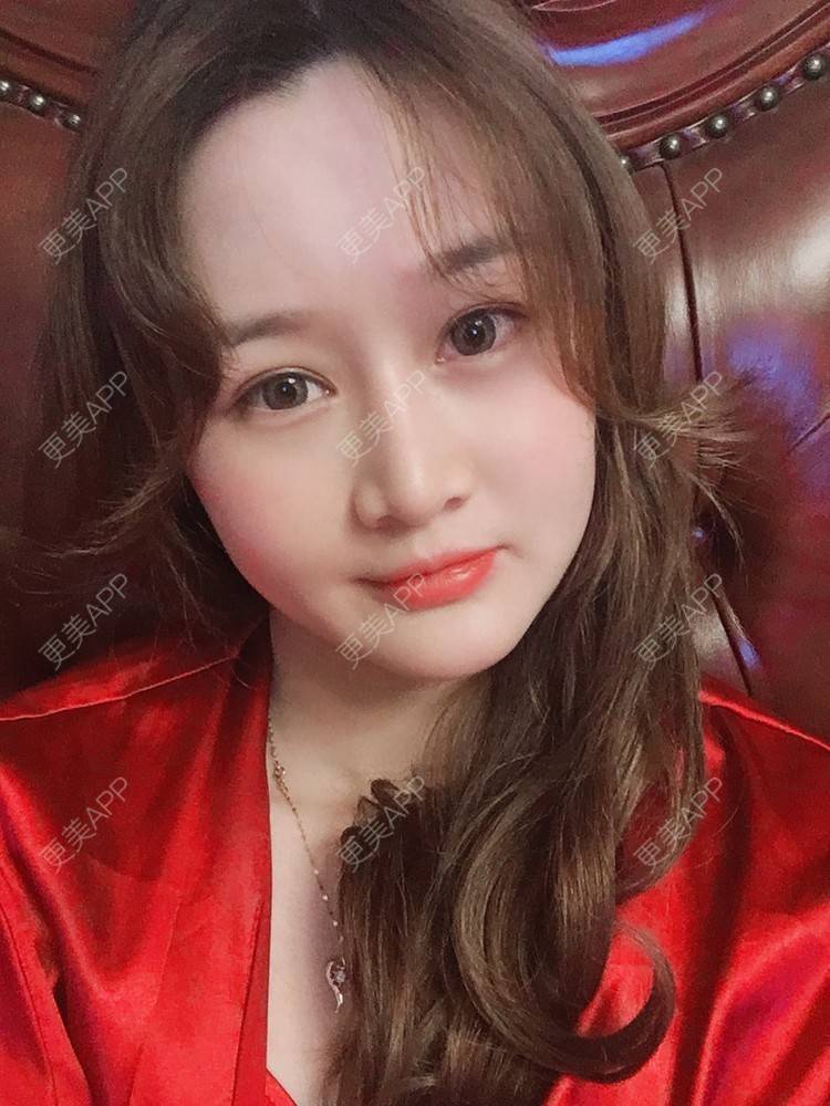 更美 - 小幸福快乐的经验 | 更美研究所 | 自体脂肪丰面颊 | 杭州 | 视频日记