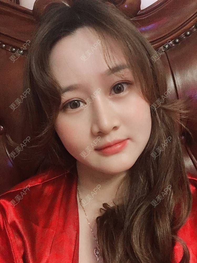 更美 - 小幸福快乐的经验 | 更美研究所 | 自体脂肪丰面颊 | 杭州 | 视频日记