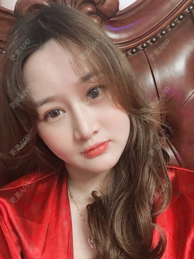 更美 - 小幸福快乐的经验 | 更美研究所 | 自体脂肪丰面颊 | 杭州 | 视频日记